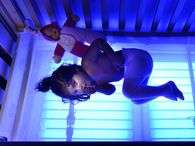 Areesha Shehzad, de 2 anos, sofre da rara s�ndrome Crigler-Najjar. Foto: Grosby Group