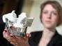 A m�dica Ingeborg van Kroonenburgh mostra uma mand�bula artificial, como a que foi utilizada na paciente. Foto: AFP