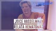 Joice Hasselmann reconstitui episódio sobre seus ferimentos