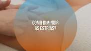 Como diminuir as estrias?