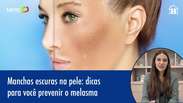 Manchas escuras na pele: dicas para prevenir o melasma