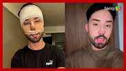 Rico Melquiades reveals what he looked like after having facial plastic surgery