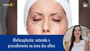 Blefaroplastia: entenda o procedimento na área dos olhos