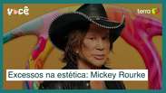 Excessos na estética: caso Mickey Rourke vai na contramão de resultados naturais