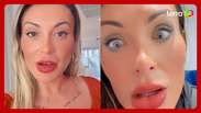 Andressa Urach relata ‘dor’ e ‘medo de ficar cega’ após cirurgia para mudar cor dos olhos