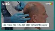 Fazer transplante capilar não significa largar os medicamentos para calvície