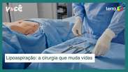 Liposuction: From the removal of fat to muscle outline, surgery changes lives