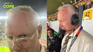 Comentarista sofre corte na cabe&ccedil;a ao ser atingido por garrafa durante jogo da Copa