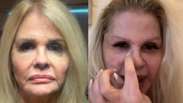 Monique Evans mostra resultado uma semana ap&oacute;s rejuvenescimento facial: 'Novo rosto'
