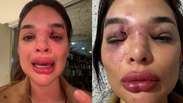 Mulher denuncia agress&otilde;es e empres&aacute;rio &eacute; preso em flagrante em SP: &lsquo;Acabou o sil&ecirc;ncio&rsquo;