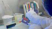 Vacina experimental contra a AIDS reduz contaminação