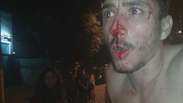 SP: jovem leva garrafada na Vila Madalena após vitória do Brasil