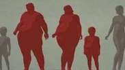 Obesidade no mundo aumenta 30%; EUA lideram ranking