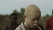 Filme reabre debate sobre perseguição a albinos na Tanzânia
