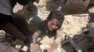 O dramático resgate de menino sob escombros após bombardeio na Síria