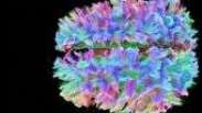 A explosão de cores nas inéditas imagens mais detalhadas do cérebro até hoje