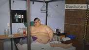 'Homem mais pesado' do mundo passa por cirurgia