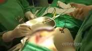 Preso faz cirurgia para retirar maconha do estômago em Francisco Beltrão
