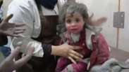 'Pelo menos no céu ele vai ter comida': o drama das crianças em meio aos bombardeios a Ghouta, na Síria