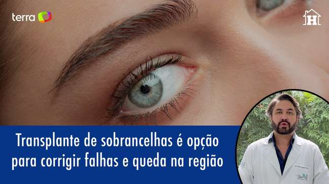Eyebrow transplant is an option to correct defects in the region