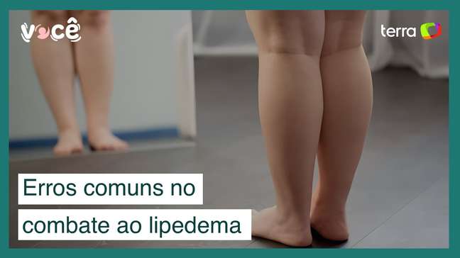 Não cometa esses erros tão comuns no combate ao lipedema