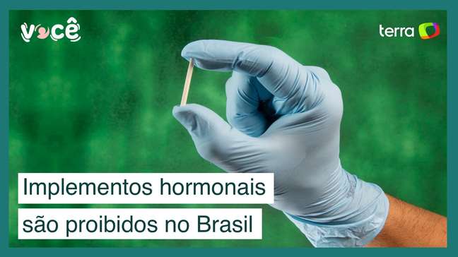 Implantes hormonais são proibidos no Brasil: A polêmica do chip da beleza