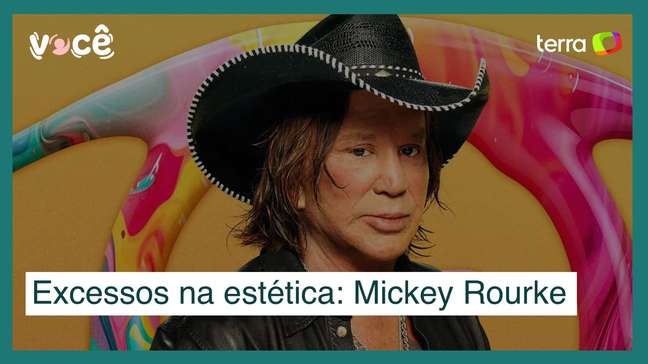 Excessos na estética: caso Mickey Rourke vai na contramão de resultados naturais