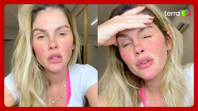 Bárbara Evans relata ‘drama’ com hemorroidas e critica tabu sobre a doença: ‘Pior dor do mundo’