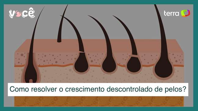 Hormonal dysfunctions cause an unsuccessful hair growth: how to resolve Hormonal dysfunctions cause an unsuccessful hair growth: how to resolve