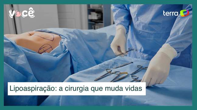 Lipoaspiração: da retirada de gordura ao contorno muscular, a cirurgia muda vidas
