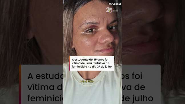 Vítima de 61 socos do ex-namorado mostra recuperação após cirurgia facial e recebe apoio nas redes