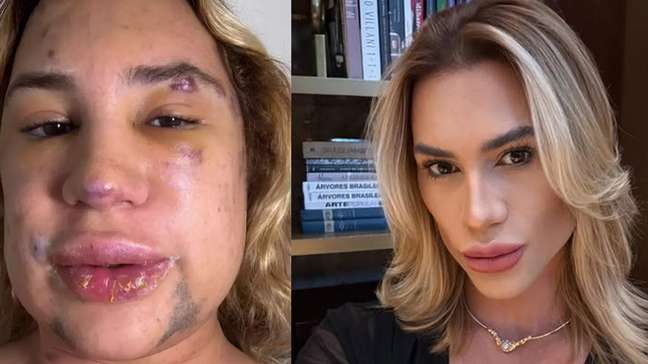 Influenciador morre aos 31 anos após complicações de procedimento estético