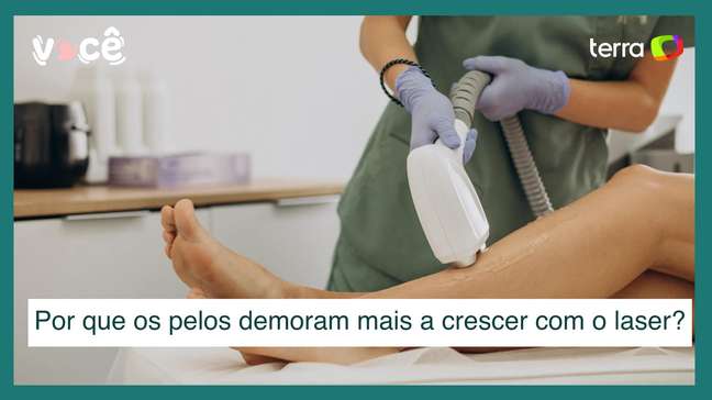 Por que os pelos demoram mais a crescer com a depilação a laser?