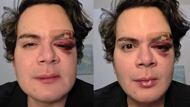 Médico tem apartamento invadido e é espancado por vizinho no Recife: ‘Covardia’