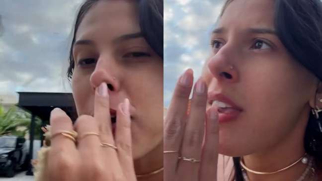 Ana Castela conta perrengues em viagem com amigos: 'Febre, marimbondo e machuquei a costela'