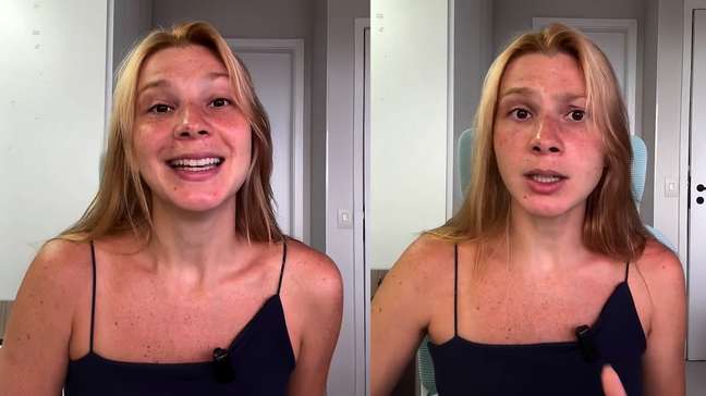 Atriz e modelo de 32 anos sofre AVC e relata momento de medo: 'Focar na reabilitação'