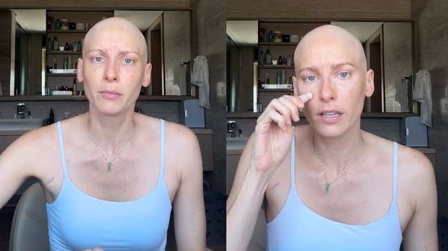 Atriz Dani Gondim desabafa sobre quimioterapia e autoestima: 'Sou privilegiada'