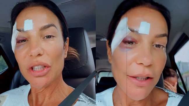 Ivete Sangalo comemora alta hospitalar após desmaio e brinca: ‘Maquiagem diferente’