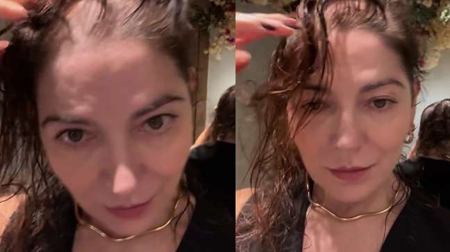 Mãe de Lucas Lucco diz que 'filho chorou' ao mostrar efeitos de sua alopecia: 'Sente a nossa dor'