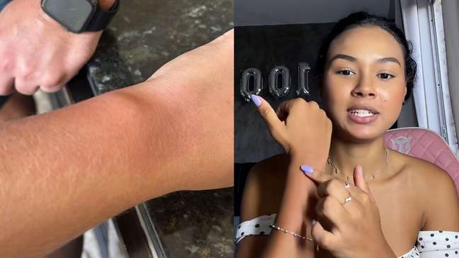 Fãs de Luan Santana relatam queimaduras após uso de pulseiras em show em BH: 'Ardeu muito'