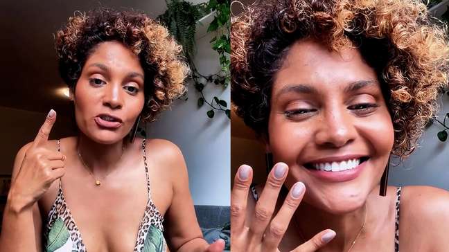 Bárbara Reis relata sinais ignorados por anos até descobrir lipedema: 'Achei que o problema era eu'