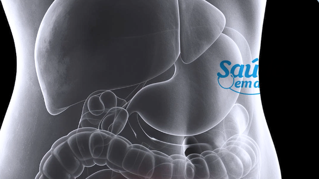 Endometriose: sinais incomuns que podem dificultar o diagnóstico