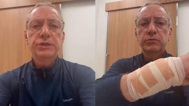 Jornalista da Globo é atacado por pitbull durante passeio com cães