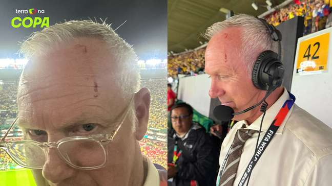 Comentarista sofre corte na cabeça ao ser atingido por garrafa durante jogo da Copa