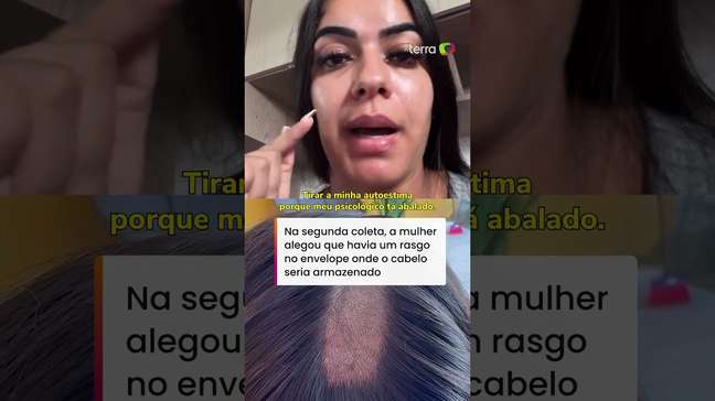 Mulher denuncia laboratório na PB após ter parte da cabeça raspada em exame para CNH #shorts