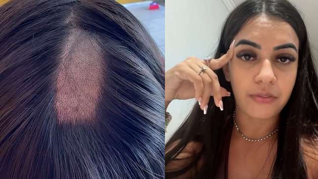 Mulher denuncia laboratório na PB após ter parte da cabeça raspada em exame toxicológico para CNH