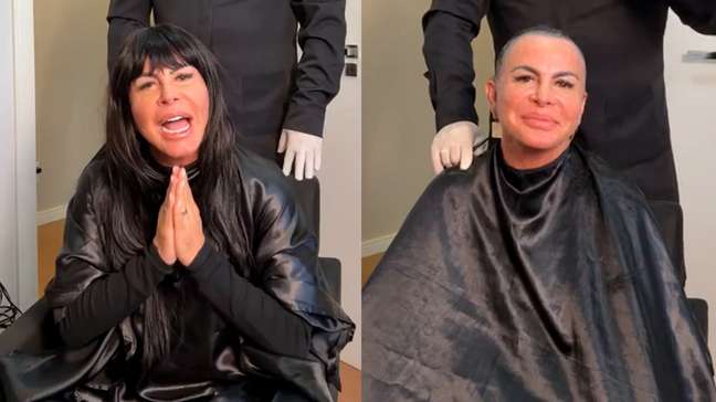 Gretchen raspa cabeça durante live antes de realizar transplante capilar