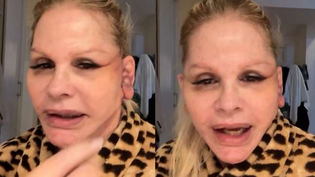 Monique Evans revela problema com reconhecimento facial de banco após cirurgia no rosto