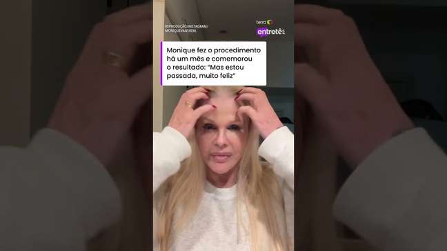Monique Evans comemora resultado de plástica: 'Chocada com a minha cara' #shorts