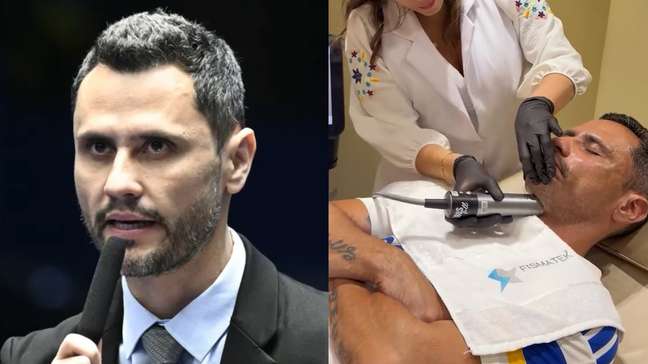 Cleitinho passa por nova harmonização facial um dia após ser eleito governador de Minas Gerais